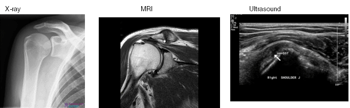 X-Rays